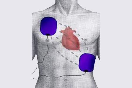 Aed anteroposterior placement for adults Porn screaming videos