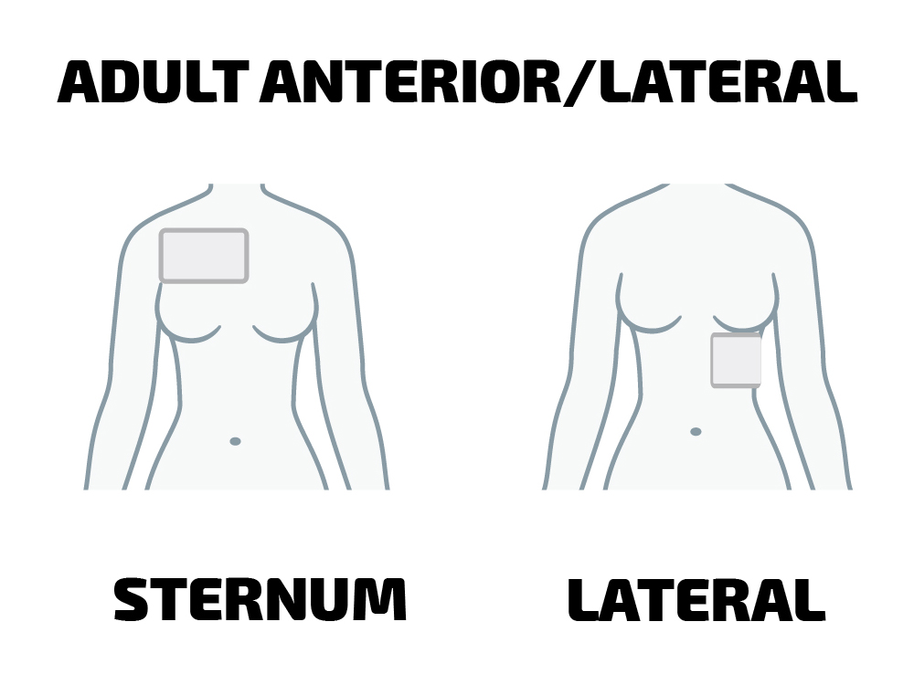 Aed anteroposterior placement for adults Noill porn
