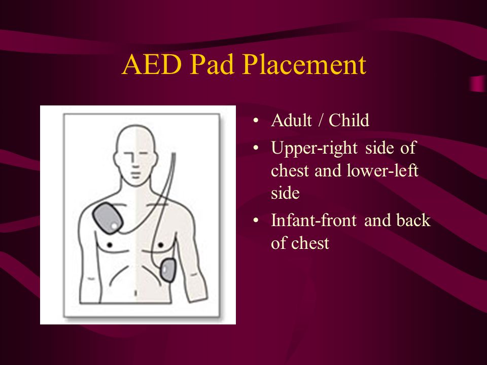 Aed anteroposterior placement for adults Pornstar slim