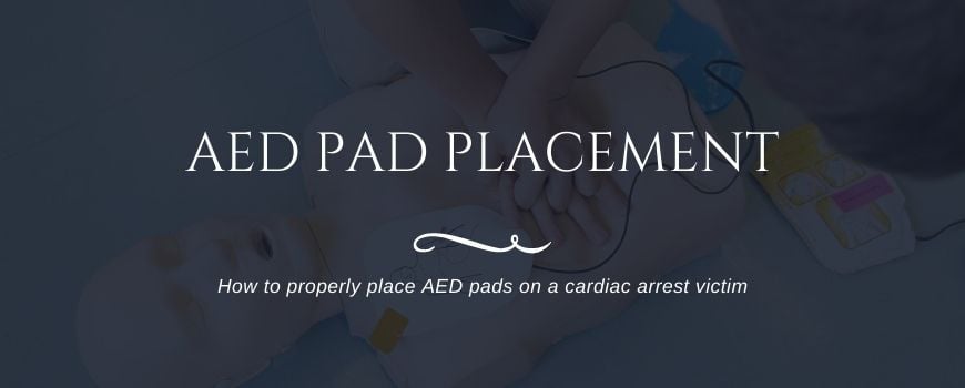 Aed anteroposterior placement for adults Pov rape porn