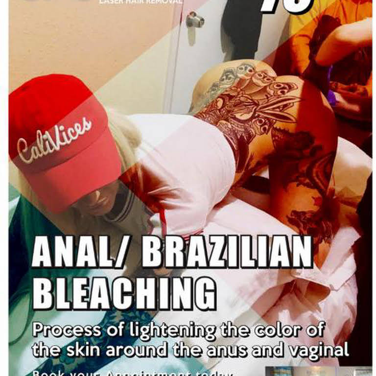 Anal bleaching las vegas Asian gallery porn