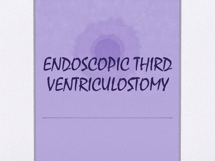 Endoscopic third ventriculostomy in adults Ava devine double anal