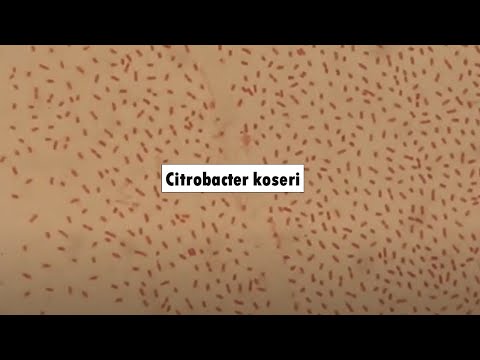 Is citrobacter koseri in urine dangerous in adults Videos pornos viejos