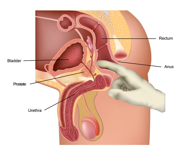 Multiple prostate orgasms Naija porn tube