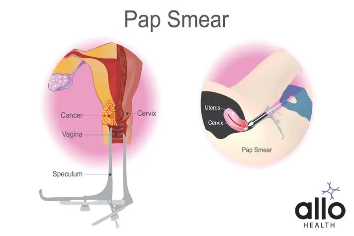 Pap smear porn Adult cursing coloring book