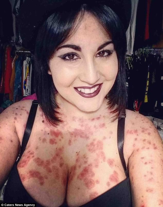 Porn stars with vitiligo Black xxx hd