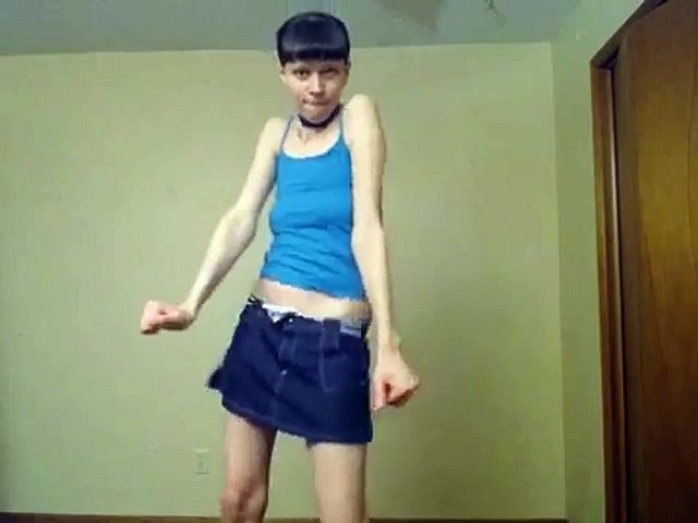 Teen webcam dance Transgender rhinoplasty seattle