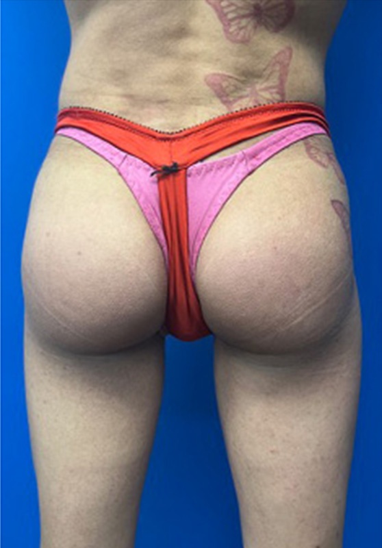 Transgender big butt Oneshot porn