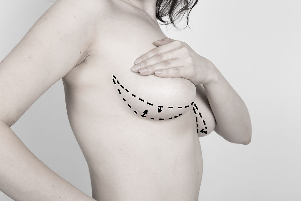 Transgender breast implants seattle Family masturbate